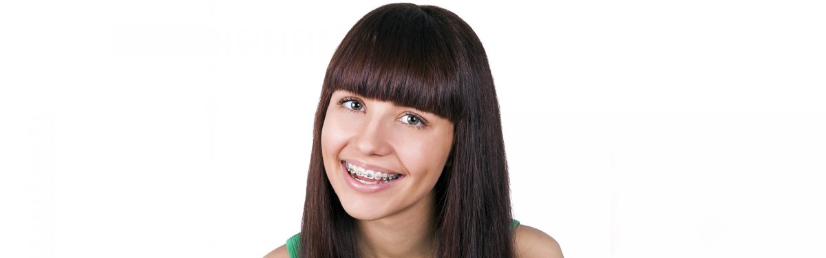 Why You Should Align Your Teeth with Accelerated Braces