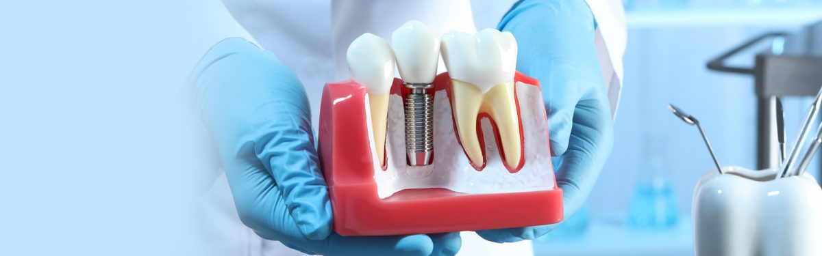 Can A Person With Dentures Get Dental Implants?